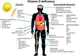 Vitamin d deficiency can cause bone loss, low bone density, and increase your chances of breaking bones. Nutrients Free Full Text Immunologic Effects Of Vitamin D On Human Health And Disease Html