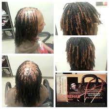 Loc Toupee With Color For Coverage Alopecia Alopecia Hairstyles Human Hair Clip Ins Hair Hacks
