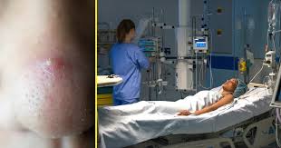 Lymphoma ( limfoma ) adalah sejenis kanser yang berkaitan dengan pembelahan secara tidak ( simptom yang dimaksudkan adalah samada pada keadaan diatas terdapat simptom seperti demam. Rawatan Kanser Limfoma Tahap 4