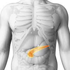 Il atteint surtout les hommes de plus de 50 ans, présentant des facteurs de risque. Cancer Du Pancreas Symptomes Et Traitement Doctissimo