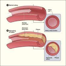 There are 2 common carotid arteries: Artery Wikipedia