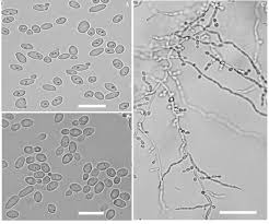 Image result for Buchnera candida