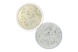 Our current project, 88 sentosa. Biokar Microbiology Reagents Supplements And Additives