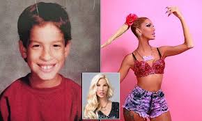 Transsexual Has Spent 1 Million On Plastic Surgery Plastic Surgery Surgery Cosmetic Surgery