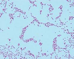 Image result for Neisseriaceae