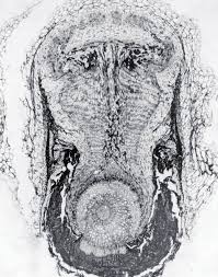 Image result for Globimetula mweroensis