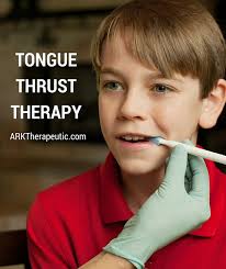 Here, flo offers helpful advice on how to stop a bleeding tongue and when to seek help. Tongue Thrust Therapy Ark Therapeutic