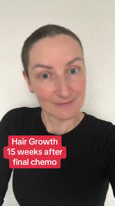 Hair Growth Progress Update after Chemo
