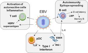 Das typische krankheitsbild der infektiösen mononukleose findet . Frontiers Epstein Barr Virus And Autoimmune Responses In Systemic Lupus Erythematosus Immunology