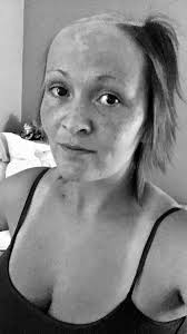 My psycho ex SCALPED me and beat me unconscious in two-hour ordeal