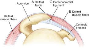Sindrome del pinzamiento subacromial, caso acromion bigliani tipo 1 en h&s canarias tenemos el caso de marianela, que acudió a nosotros para seguir. Arthroscopic Subacromial Decompression Musculoskeletal Key