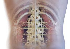 Image result for Spinal Epidural Abscess