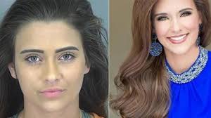 Surat Dokter Palsu Kirim Sang Ratu Kecantikan ke Penjara