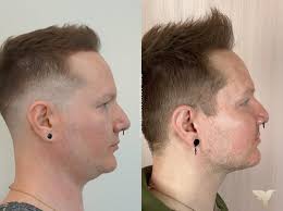 TOP 10 BEST Testosterone Replacement Therapy in Portland, OR