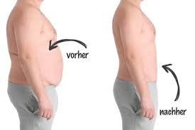We did not find results for: Stoffwechsel Kur The Gentlemen S Clinic