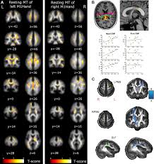 We did not find results for: Consensus Paper Combining Transcranial Stimulation With Neuroimaging Brain Stimulation Basic Translational And Clinical Research In Neuromodulation