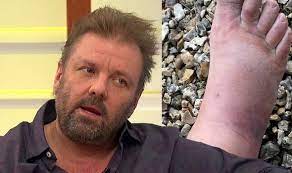 Homes under the hammer's martin roberts noticed something problematic with a property's flooring in south wales.martin visited a . Vcg8ao V5wfqom