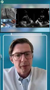 Findings from SUMMIT-MAC show that #TMVR using the Tendyne system  significantly improved #heartfailure symptoms and QoL in patients with  severe mitral annular calcification. Read the highlights at the link in  bio. #TCT2025 #