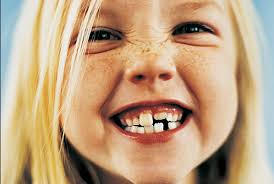 Quiz: ERUPCIÓN DENTARIA (Otros