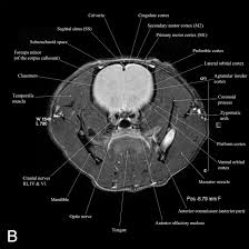 A Basic Mri Anatomy Of The Rat Brain In Coronal Sections For Practical Guidance To Neuroscientists Sciencedirect