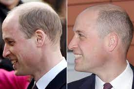 Administers 1 million vaccine doses for third straight day. Prince William S Dramatic New Hair Cut Cost 180 But He Hopes It Ll Stop Harry S Teasing Uk News Newslocker