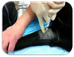 Image result for Elbow Joint Injection