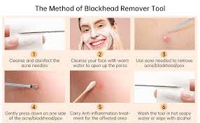 Wet a cloth in hot water and get rid of the excess water. Amazon Brand Eono Blackhead Remover Tool 4pcs For Face Professional Spot Remover Tweezers Kit For Comedone Acne Treatment Pimple Popper For Skin Care With Case Amazon Co Uk Beauty