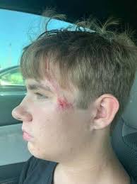 Heroic Act at Scissortail Park: 17-Year-Old Saves Drowning Toddler