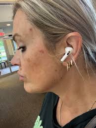 Driving home from a dermatology appt and still geeking out that my  dermatologist knew Fluevogs and even where the store in Seattle is located.  Sadly she doesn't own a pair but after