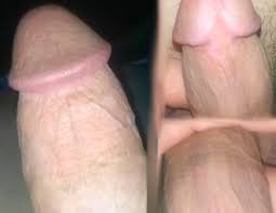 Straight guy shows his frenless cut cock and circ scar - ThisVid.com