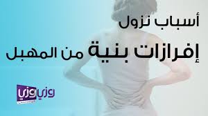 نزول افرازات بنية من المهبل بعد الجواز اسبابها مجلة بنتي