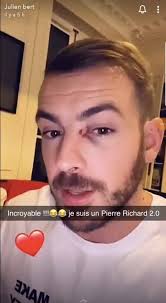 Regardez Ce Qu Elle M A Fait Julien Bert Battu Par Sa Nouvelle Compagne