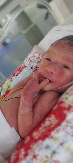 Awe, Dia Mundial di Beibi prematuro, ta sirbi komo un rekordatorio ku 1 di  kada 10 baby na mundu ta nasé prematuro. Pa konmemorá e fecha aki, Curaçao  Medical Center (CMC) ta