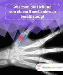 Schnellere Heilung Nach Knochenbruch Besser Gesund Leben Heilung Besser Gesund Leben Knochenbruch