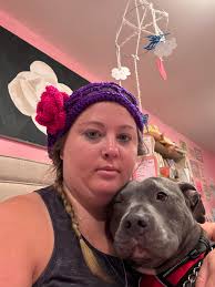 I ended plstelet chemo may of 2024. My dr has asked that I take less  medicine now to give my body a chance to totally heal better. The only  medicine im on