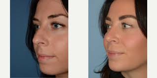 Robert A. Guida, MD Reviews, Before and After Photos, Answers