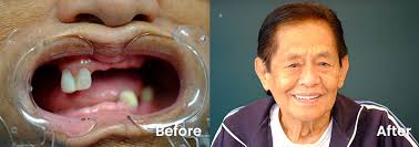 Dental Services Del Mar