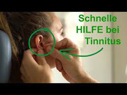 Wann Hilft Akupunktur Bei Tinnitus Youtube