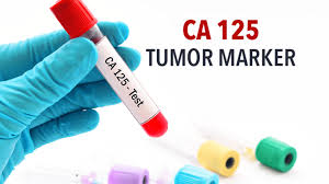 A low tumor marker does not automatically mean that there is no cancer. The Ca 125 Tumor Associated Protein Or Tumor Marker Cancerconnect