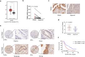 This did not simply mean he probably had eight months left to live. Trim2 Expression Is Correlated With A Poor Prognosis Of Pdac Atrim2 Download Scientific Diagram