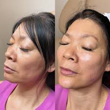 Jennifer Quinn, PA-C (@skinjectorjen) • Instagram photos and videos