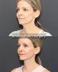 Day 1 of a journey. (Reposting Margot!)Margot is a young 58 and she's  incredible!She is a fit, energetic commercial pilot and is fascinating to  talk to. She has also been watching my