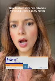 Wllah ma ana 🤨 also me in full make-up makes me wish i was this tan…  #retacnyl #tretinoine #maroc