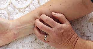 Finding cancer in its early stages (early detection) and treating it right away can raise your chances quitting smoking is the biggest step to protecting yourself from cancer. Know The Signs What Liver Disease Looks Like In Hepatitis C