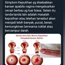 Check spelling or type a new query. Chantikku Co Alert Guys Tentang Keputihan Yang Melampau Facebook