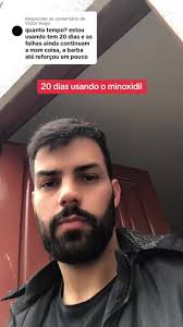 20 Dias Usando Minoxidil