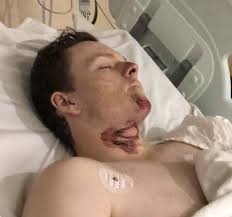 Newcastle pacing: Brad Elder's luckless run continues with heavy fall