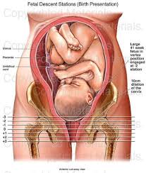 Fetal Descent Stations Birth Presentation Ob Nursing