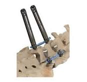 ATEC Launches InVictus MIS Tower for Spinal Fixation ...