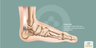 Kerusakan ini menyebabkan sendi menjadi sakit dan bengkok. Patah Kaki Tanda Dan Gejala Penyebab Cara Mengobati Cara Mencegah